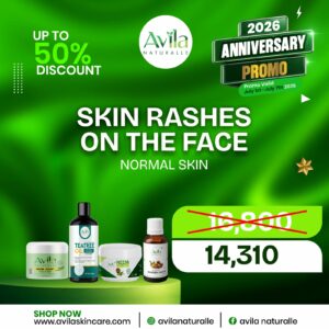 SKIN RASHES ON THE FACE(NORMAL SKIN)
