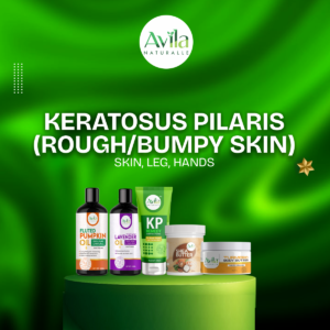 KERATOSUS PILARIS (ROUGH/BUMPY SKIN) SKIN,LEG,HANDS