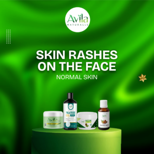 SKIN RASHES ON THE FACE(NORMAL SKIN)